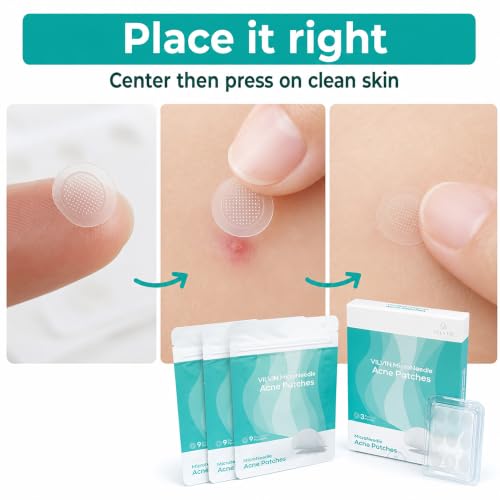 VILVIN Microdart Acne Patches - 27 Count Spot Treatment for Blind Blemishes