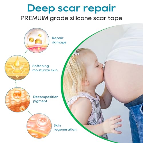 VPRIME SAFETYFY Medical-Grade Silicone Scar Tape 1.6"x 80" Roll-2M for Surgical, C-Section, Acne & Burn Scars