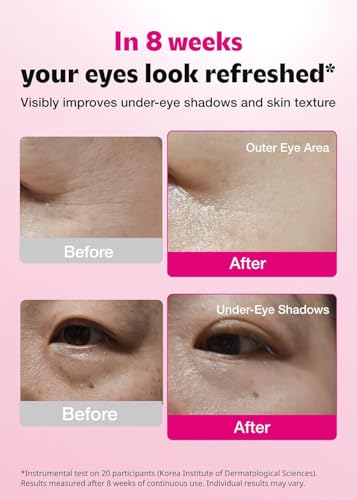 ISOI Hydrating Eye Patches with Hyaluronic Acid for Puffiness Dark Circles 90 Count
