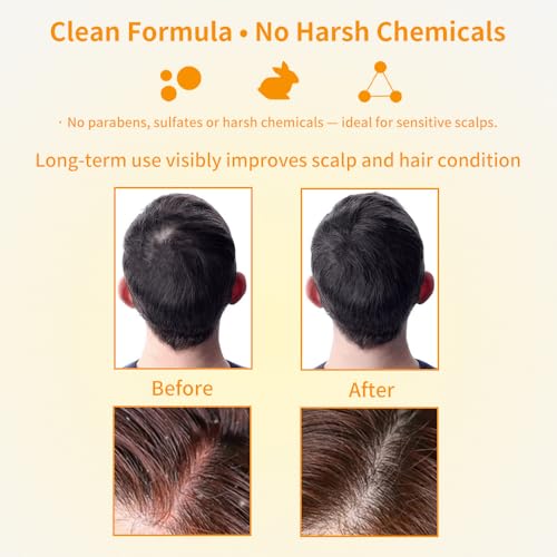 BIH Turmeric & Ginger Shampoo Bars - 2 Pack for Hair Growth