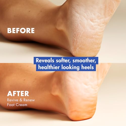 Handmade Heroes Peppermint Foot Cream - Natural Moisturizing Heel Repair