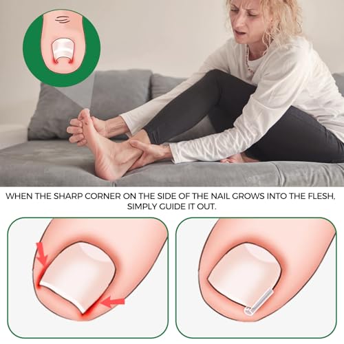 Pain-Free Ingrown Toenail Removal Kit with Straightener Strips - 62 Pcs