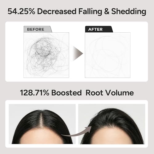 BANANAL Silica 7000 Scalp Serum Roll-On for Thinning Hair, 0.5 fl oz