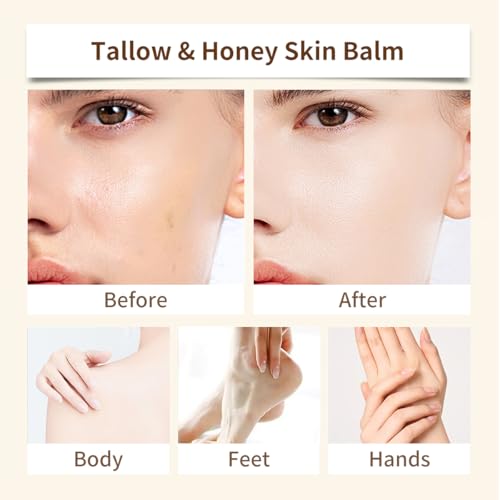 AISAZG Tallow Honey Face Moisturizer with Hyaluronic Acid & Niacinamide, Non-Greasy 4.23oz