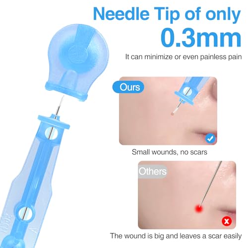Sterile Pimple Needle Kit - 80 Ultra-Fine Acne Needles & 108 Stickers