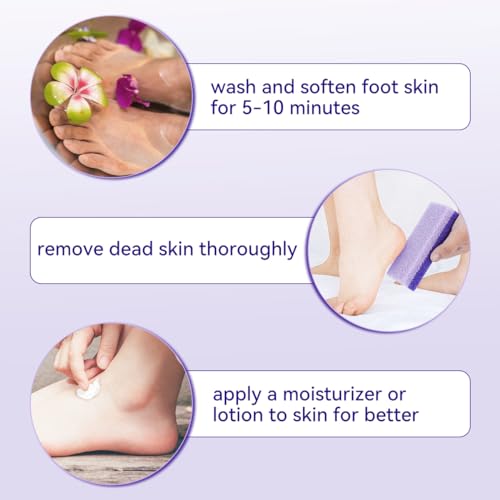 4 Pcs Premium Pumice Stone Set for Callus Removal and Foot Scrubbing