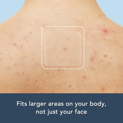 Rael Miracle XL Hydrocolloid Pimple Patches - 8 Ct for Large Blemishes