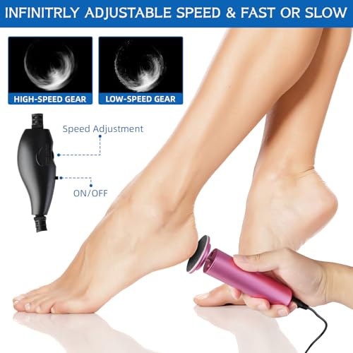 Electric Foot Callus Remover with 60 Sandpaper Discs & Speed Control – Pedicure Grinder for Men & Women
