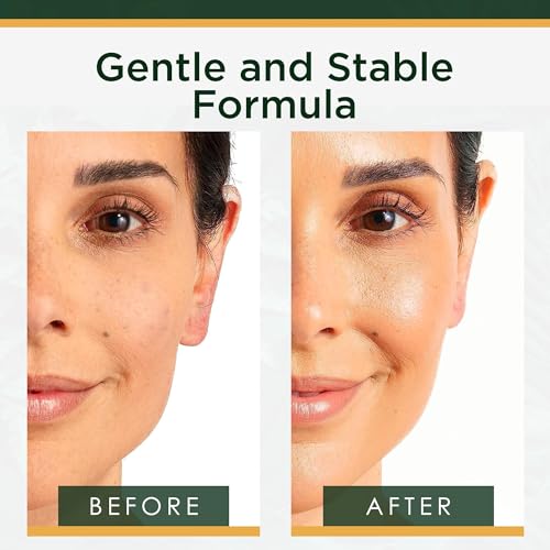 Tree of Life Vitamin C Serum for Face – Brightening & Hydrating Anti-Aging