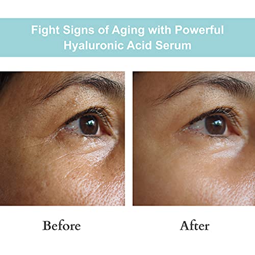 JOYAL BEAUTY 100% Pure Hyaluronic Acid Serum 1.5% - 2 Fl Oz