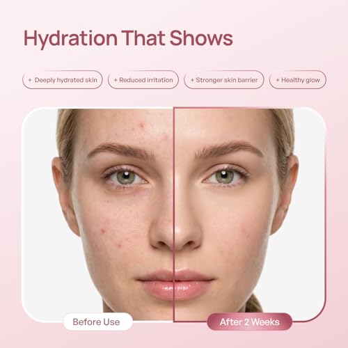 PLANTIFIQUE Korean PDRN Milky Toner - Hydrating Glass Skin Formula