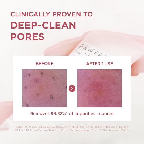 SKIN1004 Poremizing Deep Cleansing Foam with Himalayan Pink Salt, 125ml