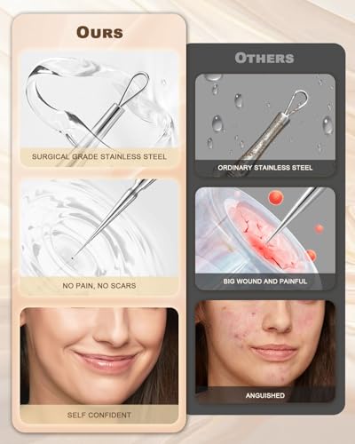 SGNEKOO Titanium Gold Facial Milia Removal Tool & Whitehead Extractor Kit