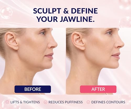 Stylia Collagen Double Chin Mask for Face & Neck Tightening, Lifting & Contouring