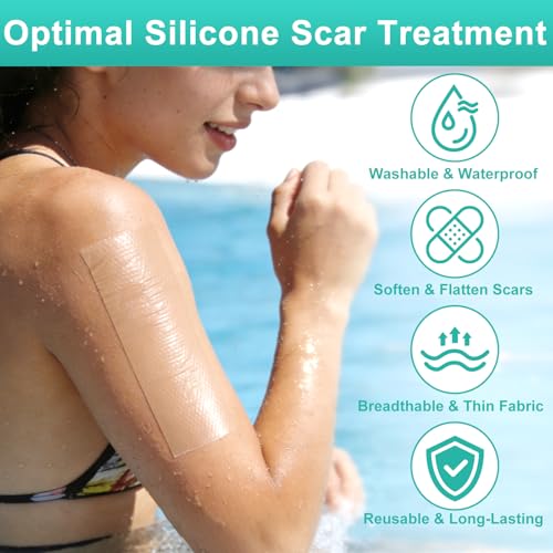GEAUPASE Silicone Scar Sheets - Reusable 1.6” x 120” Roll for All Scars