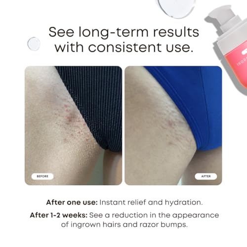 Original Kessa Exfoliating Glove - Lively Pink - Microdermabrasion Exfoliating Mitts, Removes unwanted dead skin, dirt and grime and Keratosis Pilaris. Great for spray tan removal. 1 unit | Exfoliate, Smooth Skin, Renew Skin