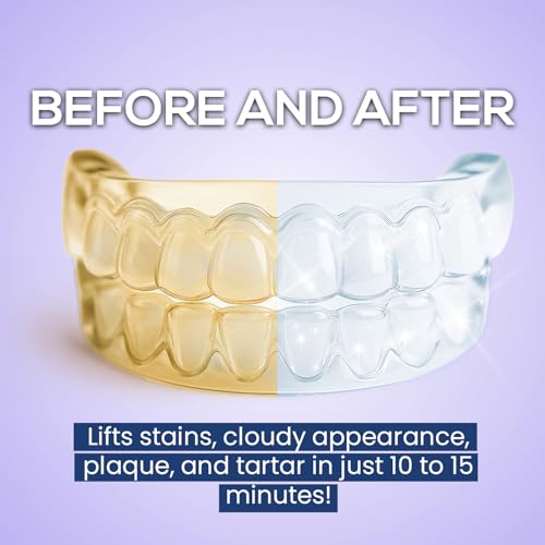Venus Visage 120 Denture & Retainer Cleaning Tablets - 4 Month Supply for Invisalign, Night Guards & Ultrasonic Cleaners