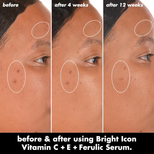 e.l.f. SKIN Bright Icon Vitamin C + E Face Serum 1 Fl Oz - Soothing & Brightening