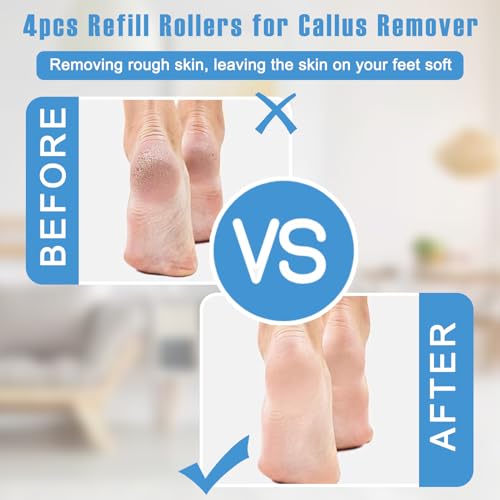 ZJchao 4-Pack Replacement Rollers for Callus Remover