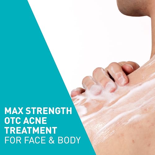 CeraVe Acne Foaming Face & Body Wash with Benzoyl Peroxide 10%, 5oz