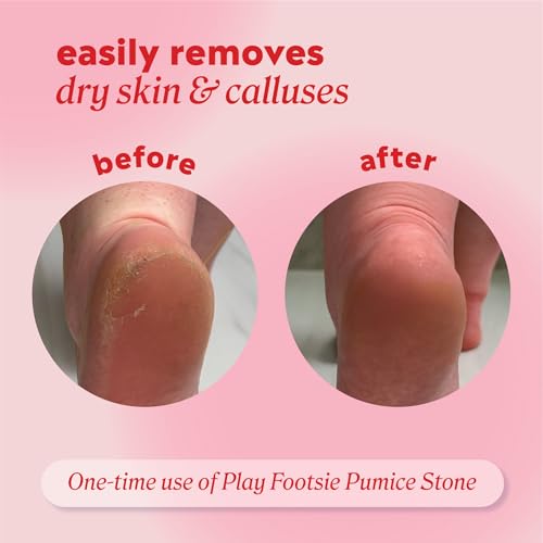 Onyx Professional Double-Sided Pumice Stone for Feet - 2 Pack