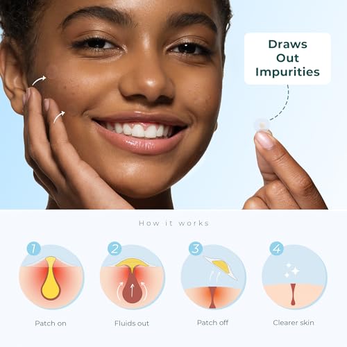 Hydrocolloid Acne Pimple Patches - Vegan, Hypoallergenic (110 Count)