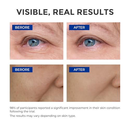SKINERSE 0.3% Retinol Serum for Face – Anti-Aging Collagen Facial Treatment