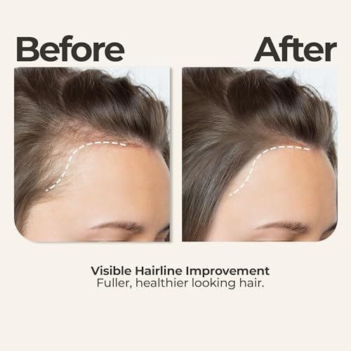 Zen Routine Rosemary Oil for Hair Growth Set with Scalp Massager