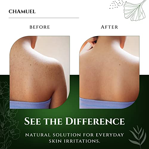 Chamuel Tea Tree Body Wash with Peppermint & Eucalyptus - 11.8oz Antifungal Daily Shower Gel for Itchy Skin & Body Odor