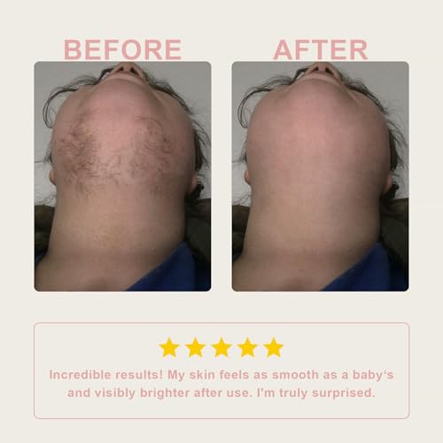 Facial Hair Removal for Women Face, Flawless Facial Depilatory Cream, At Home Defined Hair Remover Sensitive Skin Safe, 1.69 Fl Oz