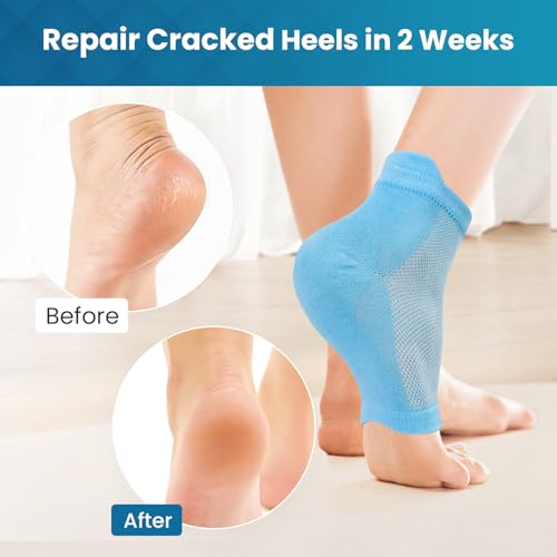 Kimihome Moisturizing Heel Socks - Jojoba & Olive Oil, 2 Pairs, Blue Calm