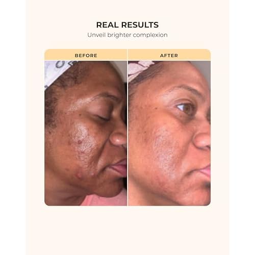 Buttah Skin 3pc Transforming Skincare Kit for Melanin | Rich Skin Revitalizing CocoShea Cream Moisturizer 2 oz | 15% Vitamin C Serum 1 oz | Buttah Cleanser 3.4 oz | Black Founded Skincare
