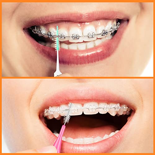 Zopeal 250 Pcs Interdental Brushes & Tooth Floss Picks Set