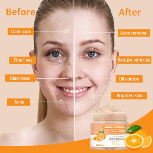 Vitamin C & Retinol Face Scrub for Deep Cleansing & Brightening - Gentle Exfoliating Facial Wash