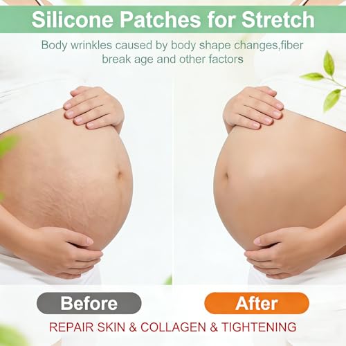 VolksRose Reusable Silicone Belly Patch for Lifting - Stomach tape for Postpartum Recovery & Stretch Marks, Moisturizing Anti-Wrinkle Skin Tape for Tummy Shaping, Firming & Invisible Wear Overnight