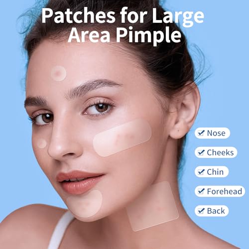 QUSTERE Hydrocolloid Acne Patches - 380 Count Variety Pack for Face