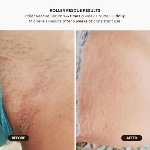 Glo Melanin Dark Spot Topical Roll-On ? 1.7 fl oz / 50 ml ? Targeted Brightening for Inner Thighs & Underarms ? Kojic Acid, Licorice & Willow Bark ? Vegan, Paraben-Free Topical Skin Exfoliant