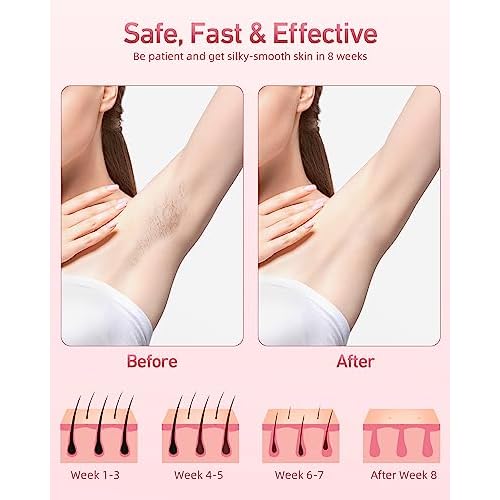 IPL Laser Permanent Hair Removal Device with Protective Goggles, 86% Hair Reduction in 3 Weeks & 5 Custom Energy Levels, Perfect for Men & Women's At-Home Full Body and Face, White