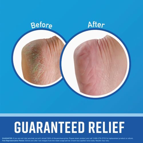 O'Keeffe's Healthy Feet Foot Cream - Intensive Moisturizing Treatment