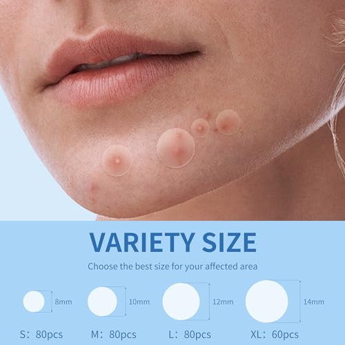 Daolyo 300 Pimple Patches for Face - 4 Sizes Hydrocolloid Acne Spot Treatment