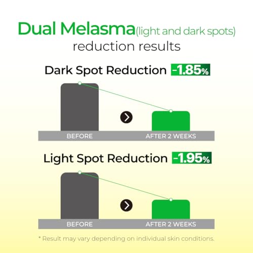 IZEZE Lemon CNA Serum | Dark Spot Correcting & Illuminating 1.01 fl. oz