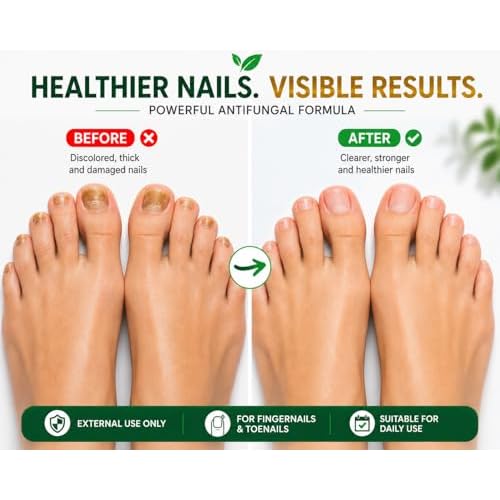 Nail Treatment, Tratamiento Para U?as, Extra Strength Nail Renewal, Made in USA