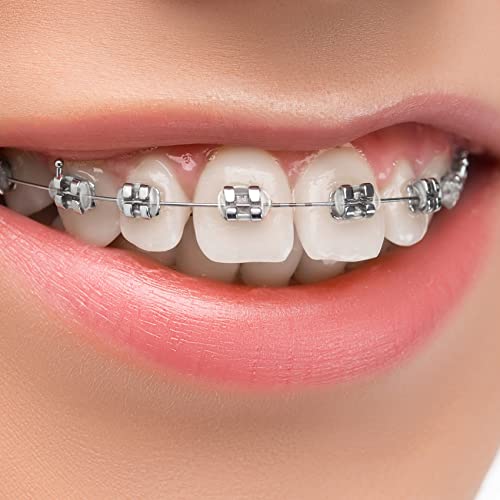 Annhua Clear Orthodontic Ligature Ties 1040 pcs - Dental Braces Color Bands