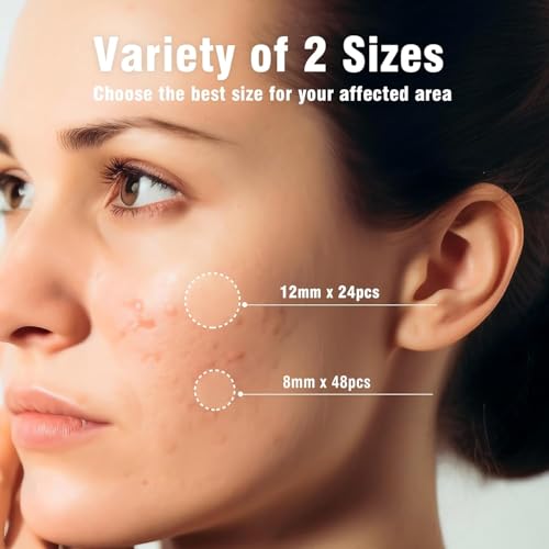 OUKEYA Hydrocolloid Acne Pimple Patches - 36 Invisible Spot Treatments