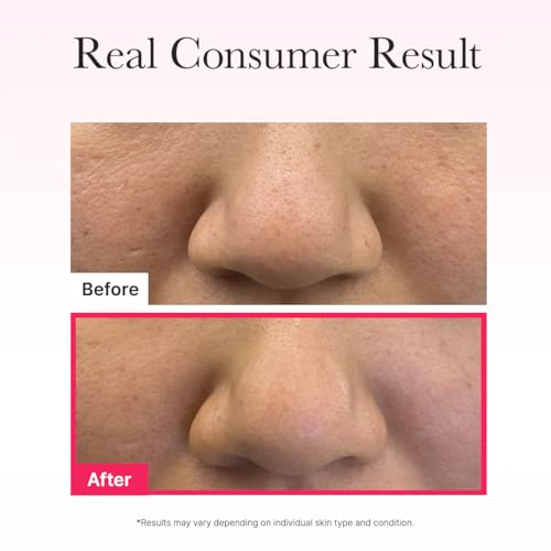 ARENCIA Red Collagen Jello Mask - Hydrating Overnight Hydrogel Mask Set (4 Sheets)