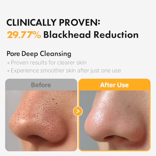 Hanskin PHA Pore Cleansing Oil for Sensitive Skin - 10.14 oz Makeup Remover