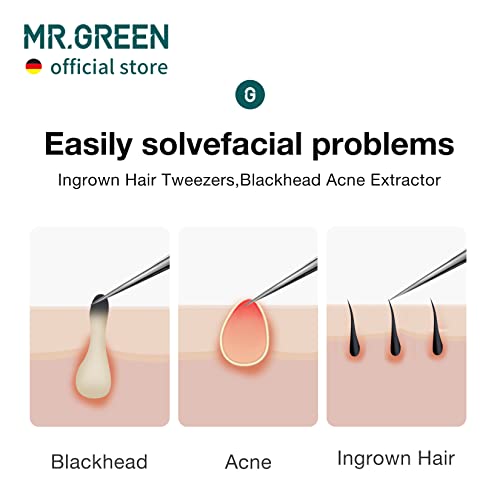 MR.GREEN Pointed Tip Tweezers for Ingrown Hair & Eyebrows