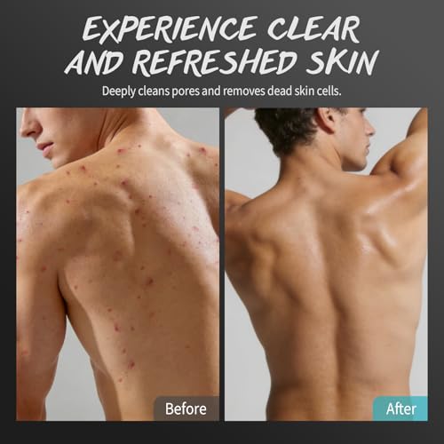 Men's Exfoliating Body Scrub with Tea Tree Oil & BHA/AHA