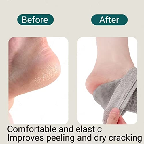 YSAFAI 8 Pairs Toeless Moisturizing Socks for Cracked Heels