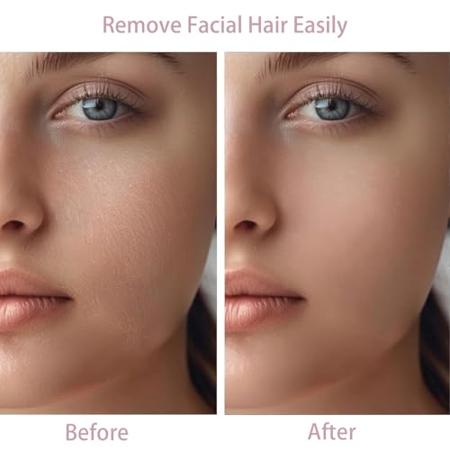 tuokiy Women Facial Hair Removal Device Battery Operated with 2 Replacement Heads,Ladies Face Shaver for Peach Fuzz Upper Lip,Chin, Facial Hair Removal for Women, Rose Gold